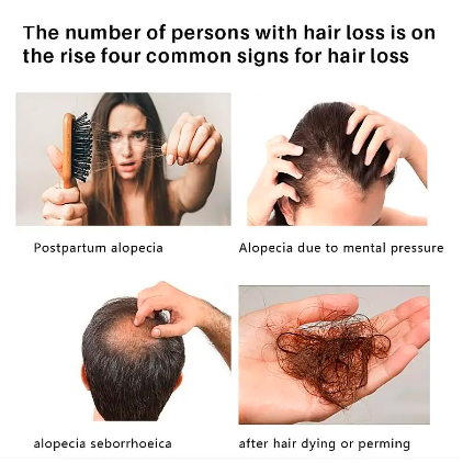 Ginger Hair Growth Spray Serum For Anti Hair Loss Essential Oil Products Fast Treatment Prevent Hair Thinning Dry Frizzy Repair - Amado Deals - wholesale and distributors with free shipping in United States Ginger Hair Growth Spray Serum For Anti Hair Loss Essential Oil Products Fast Treatment Prevent Hair Thinning Dry Frizzy Repair - Amado Deals - wholesale and distributors with free shipping in United States
